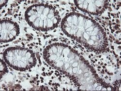CHN1 Mouse anti-Human, Clone: OTI2G6, lyophilized, TrueMAB 100 &mu;g; Unconjugated:Antibodies,