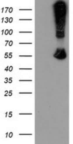 CHN1 Mouse anti-Human, Clone: OTI1C9, lyophilized, TrueMAB 100 &mu;g; Unconjugated:Antibodies,