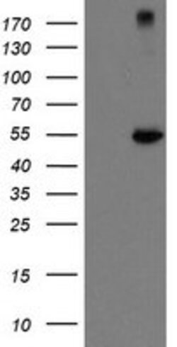 CHN1 Mouse anti-Human, Clone: OTI1B7, lyophilized, TrueMAB 100 &mu;g; Unconjugated:Antibodies,