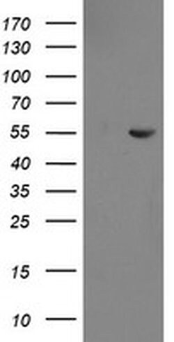 CHN1 Monoclonal Antibody (OTI2A1), TrueMAB , OriGene 100 &mu;L; Unconjugated:Antibodies,