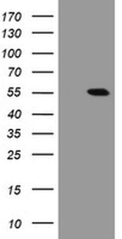 CHN1 Monoclonal Antibody (OTI2D10), TrueMAB , OriGene 30 &mu;L; Unconjugated:Antibodies,