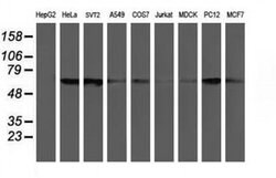 CHN1 Monoclonal Antibody (OTI3C6), TrueMAB , OriGene 30 &mu;L; Unconjugated:Antibodies,