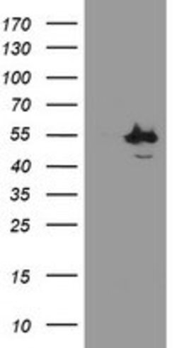 CHN1 Mouse anti-Human, Clone: OTI2G6, lyophilized, TrueMAB 100 &mu;g; Unconjugated:Antibodies,