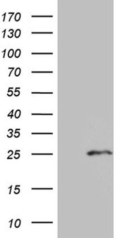 CHP1 Monoclonal Antibody (OTI2E2), TrueMAB , OriGene 100 &mu;L; Unconjugated:Antibodies,