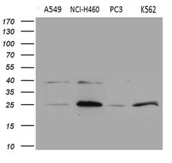 CHP1 Monoclonal Antibody (OTI1D11), TrueMAB , OriGene:Antibodies:Primary