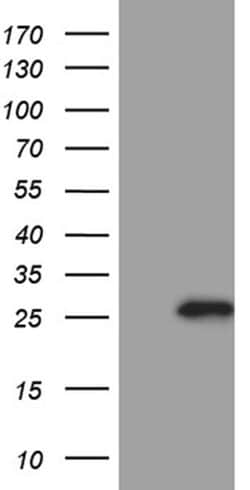 CHP1 Monoclonal Antibody (OTI6F5), TrueMAB , OriGene 100 &mu;L; Unconjugated:Antibodies,