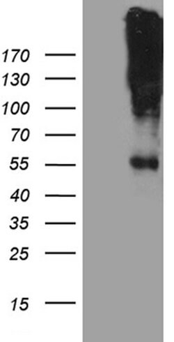 CHRNA5 Mouse anti-Human, Clone: OTI8H10, lyophilized, TrueMAB 100 &mu;g;