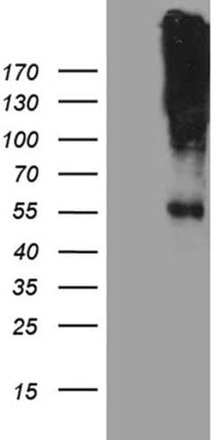 CHRNA5 Monoclonal Antibody (OTI8H10), TrueMAB , OriGene 100 &mu;L; Unconjugated:Antibodies,