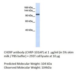 CHERP Rabbit anti-Human, Mouse, Non-human Primate, Rat, Polyclonal, FabGennix 200 &mu;L | Buy Online | Fabgennix Inc | Fisher Scientific