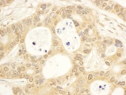 CIAPIN1 Rabbit anti-Human, Polyclonal, Bethyl Laboratories 10 &mu;L; Unconjugated:Antibodies,