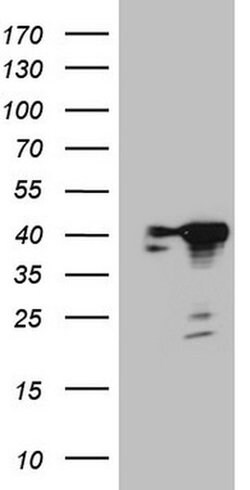 CIAPIN1 Monoclonal Antibody (OTI1C11), TrueMAB , OriGene 100 &mu;L; Unconjugated:Antibodies,