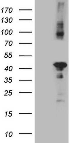 CIAPIN1 Monoclonal Antibody (OTI5A6), TrueMAB , OriGene 100 &mu;L; Unconjugated:Antibodies,
