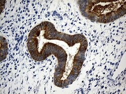 CIB1 Monoclonal Antibody (OTI1B8), TrueMAB , OriGene 100 &mu;L; Unconjugated:Antibodies,