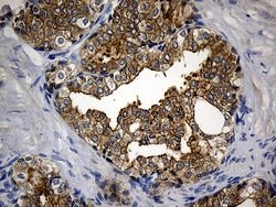 CIB1 Monoclonal Antibody (OTI1B8), TrueMAB , OriGene 100 &mu;L; Unconjugated:Antibodies,