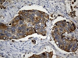 CIB1 Monoclonal Antibody (OTI1B8), TrueMAB , OriGene:Antibodies:Primary