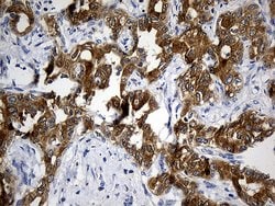 CIB1 Monoclonal Antibody (OTI1B8), TrueMAB , OriGene 100 &mu;L; Unconjugated:Antibodies,