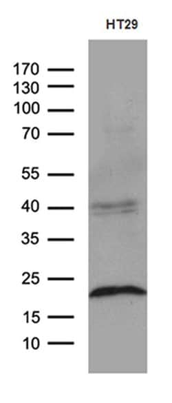 CIB1 Monoclonal Antibody (OTI1B8), TrueMAB , OriGene 100 &mu;L; Unconjugated:Antibodies,