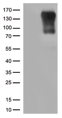 CIITA Monoclonal Antibody (OTI7B12), TrueMAB , OriGene:Antibodies:Primary