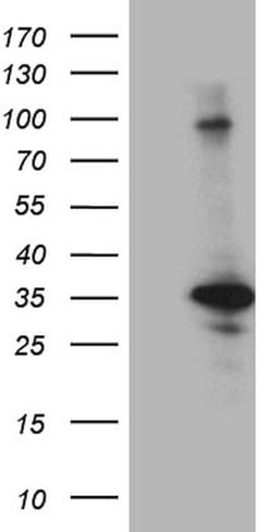 CINP Monoclonal Antibody (OTI8E4), TrueMAB , OriGene 30 &mu;L; Unconjugated:Antibodies,