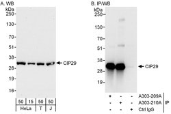 CIP29 Rabbit anti-Human, Polyclonal, Bethyl Laboratories 100 &mu;L; Unconjugated:Antibodies,