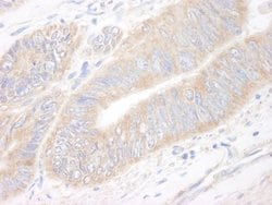 CIP2A Rabbit anti-Human, Polyclonal, Bethyl Laboratories 100 &mu;L; Unconjugated:Antibodies,