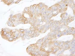 CIP2A Polyclonal Antibody, Bethyl Laboratories 10 &mu;L; Unconjugated:Antibodies,
