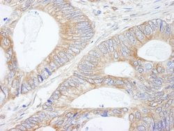 CIP2A Polyclonal Antibody, Bethyl Laboratories 10 &mu;L; Unconjugated:Antibodies,
