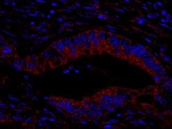 CIP2A Polyclonal Antibody, Bethyl Laboratories 10 &mu;L; Unconjugated:Antibodies,