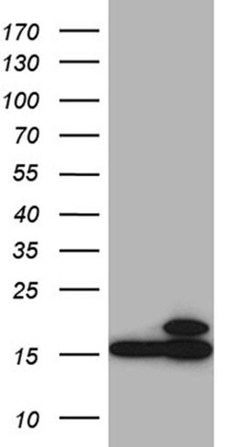 CISD2 Monoclonal Antibody (OTI4E8), TrueMAB , OriGene 100 &mu;L; Unconjugated:Antibodies,