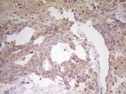 CITED1 Mouse anti-Human, Clone: OTI3C12, lyophilized, TrueMAB 100 &mu;g;