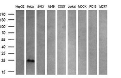 CITED1 Mouse anti-Human, Clone: OTI1C6, lyophilized, TrueMAB 100 &mu;g;