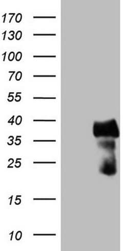 CITED1 Monoclonal Antibody (OTI3B1), TrueMAB , OriGene 100 &mu;L; Unconjugated:Antibodies,