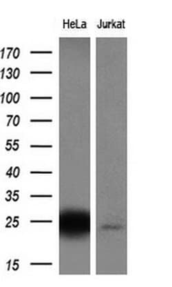 CITED1 Monoclonal Antibody (OTI3B1), TrueMAB , OriGene 100 &mu;L; Unconjugated:Antibodies,