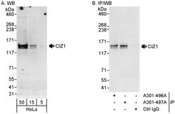 CIZ1 Rabbit anti-Human, Polyclonal, Bethyl Laboratories 100 &mu;L; Unconjugated:Antibodies,