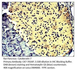 Cytokeratin 7 Rabbit anti-Human, Mouse, Rat, Polyclonal, FabGennix 200 &mu;L | Buy Online | Fabgennix Inc | Fisher Scientific