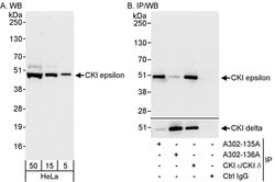 CKI epsilon Rabbit anti-Human, Polyclonal, Bethyl Laboratories 100 &mu;L;