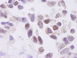 CKII alpha Polyclonal Antibody, Bethyl Laboratories:Antibodies:Primary