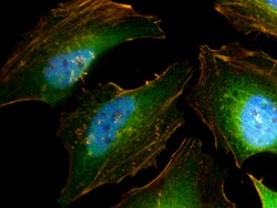 IRAK1 Polyclonal Antibody, CoraLite488, Proteintech 100 μL; CoraLite488:Antibodies,
