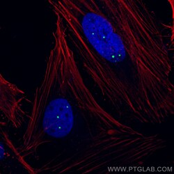 Coilin Polyclonal Antibody, CoraLite488, Proteintech 100 μL; CoraLite488:Antibodies,