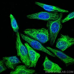 Cytokeratin 7 Polyclonal Antibody, CoraLite488, Proteintech 100 &mu;L | Buy Online | Proteintech Group Inc | Fisher Scientific