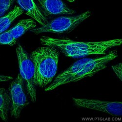 Cytokeratin 7 Polyclonal Antibody, CoraLite488, Proteintech 100 &mu;L | Buy Online | Proteintech Group Inc | Fisher Scientific