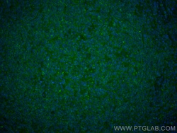 CD45 Monoclonal Antibody (4E9B2), CoraLite488, Proteintech 100 μL; CoraLite488:Antibodies,