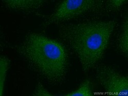 MMP3 Monoclonal Antibody (1F5A9), CoraLite488, Proteintech 100 μL; CoraLite488:Antibodies,