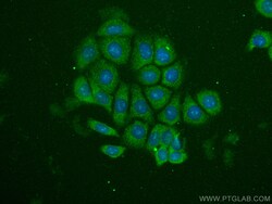 MMP2 Monoclonal Antibody (2B10D1), CoraLite488, Proteintech 100 &mu;L;