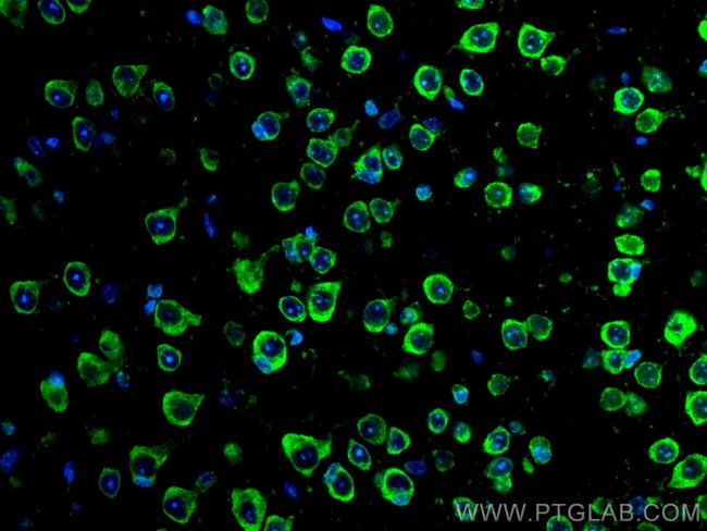 RIC8A Monoclonal Antibody (1E3B11), CoraLite488, Proteintech 100 μL ...