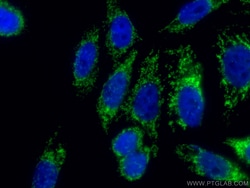TOM20 Monoclonal Antibody (1D6F5), CoraLite488, Proteintech 100 &mu;L;