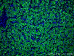 GCK Monoclonal Antibody (1C3A3), CoraLite488, Proteintech 100 &mu;L; CoraLite488:Antibodies,