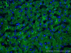 GCK Monoclonal Antibody (1C3A3), CoraLite488, Proteintech 100 &mu;L; CoraLite488:Antibodies,