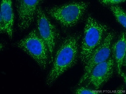 Tim23 Monoclonal Antibody (3H10F5), CoraLite488, Proteintech 100 &mu;L | Buy Online | Proteintech Group Inc | Fisher Scientific