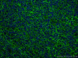 NT5E, CD73 Monoclonal Antibody (1G5G8), CoraLite488, Proteintech 100 &mu;L;